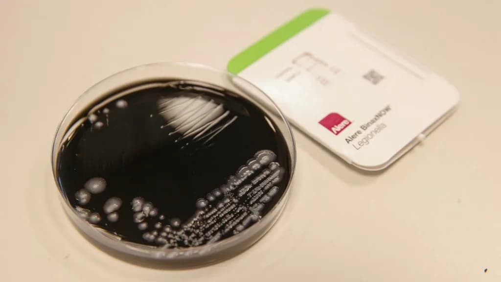 Keresik, de nem lelik a Legionella fertőzés gócát