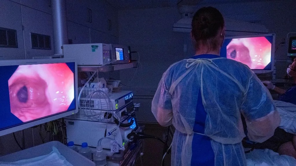 Két figyelmeztető jel, amit a vastagbélráknál komolyan kell venni