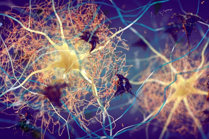 Ezek a bizarr vizuális tünetek jelezhetik az Alzheimer-kórt