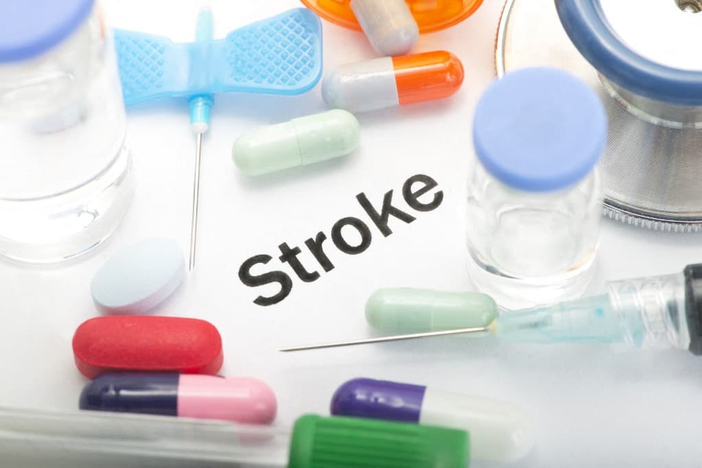 Stroke: ennél a vércsoportnál alakulhat ki nagyobb eséllyel