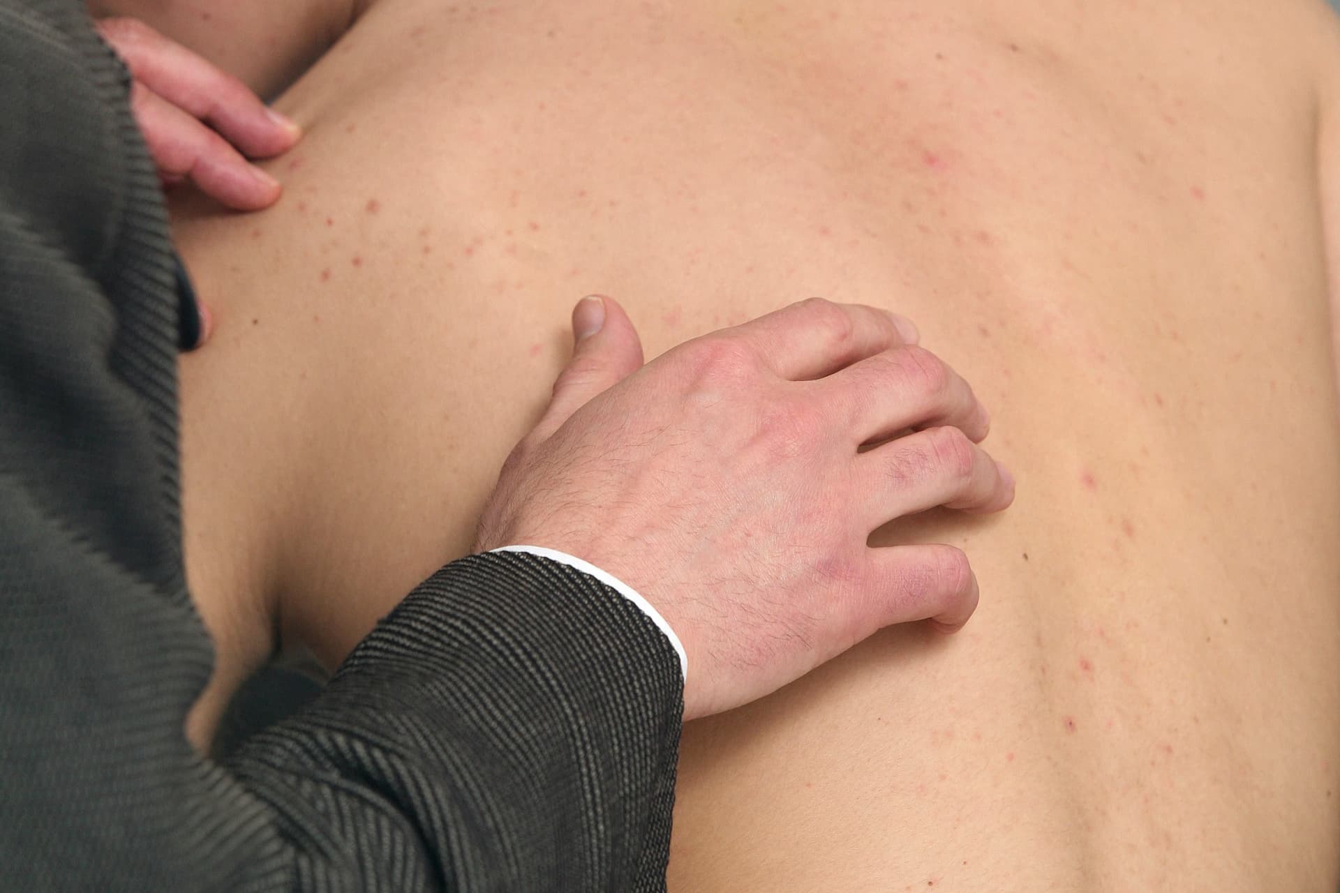 Rheumatoid arthritis: ezek lehetnek a figyelmeztető jelek