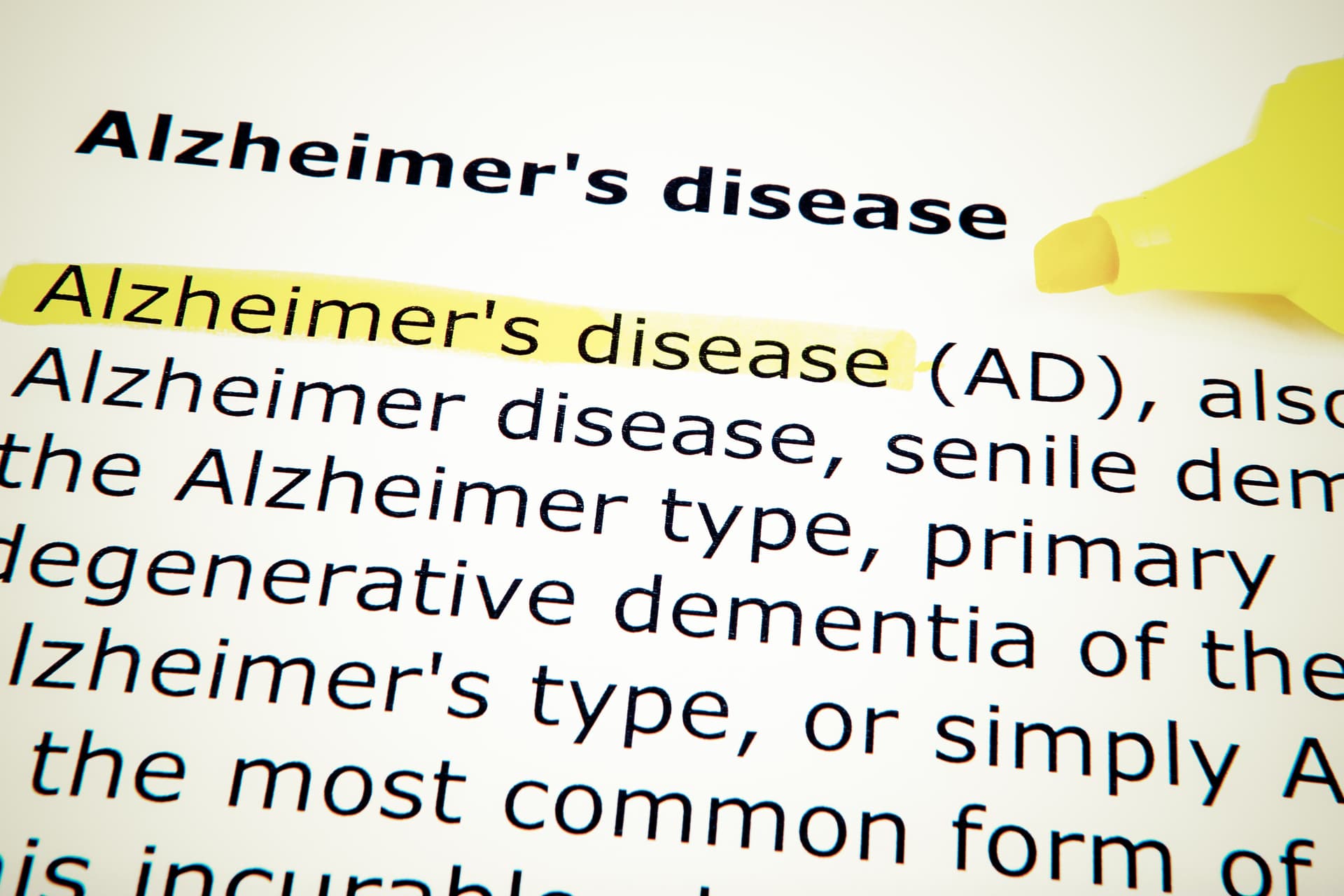 Új módszert fedeztek fel az Alzheimer-kór elleni küzdelemben