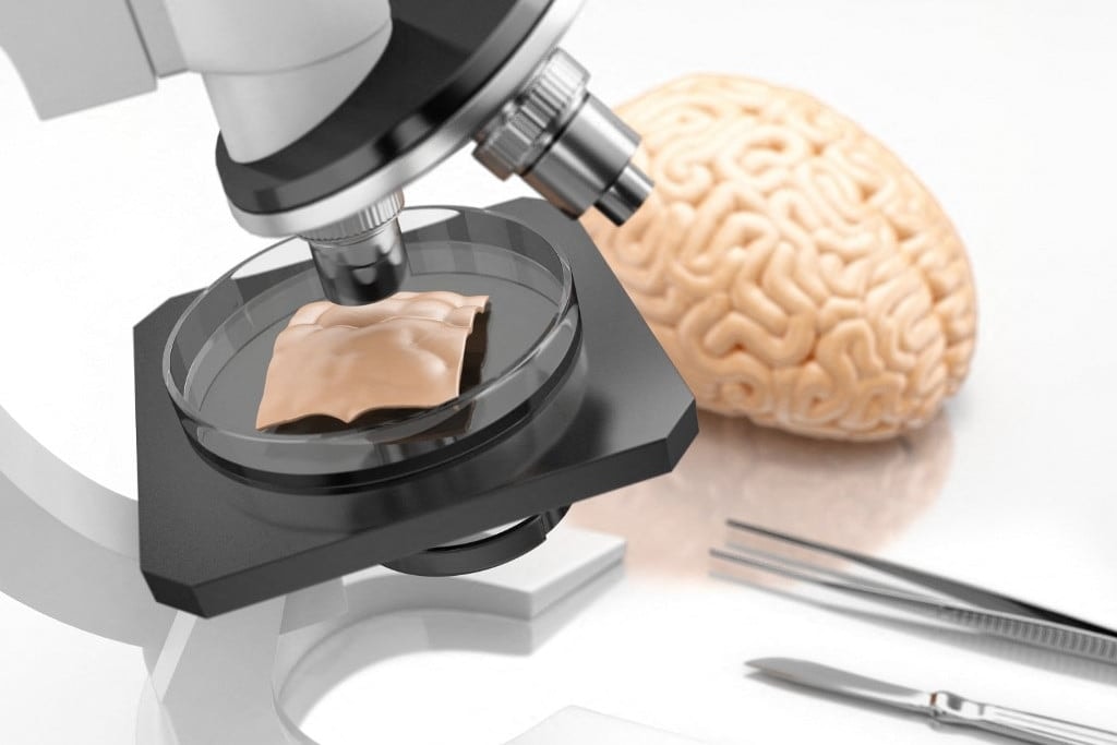 Felfedezhették az Alzheimer-kór kiváltó okát?