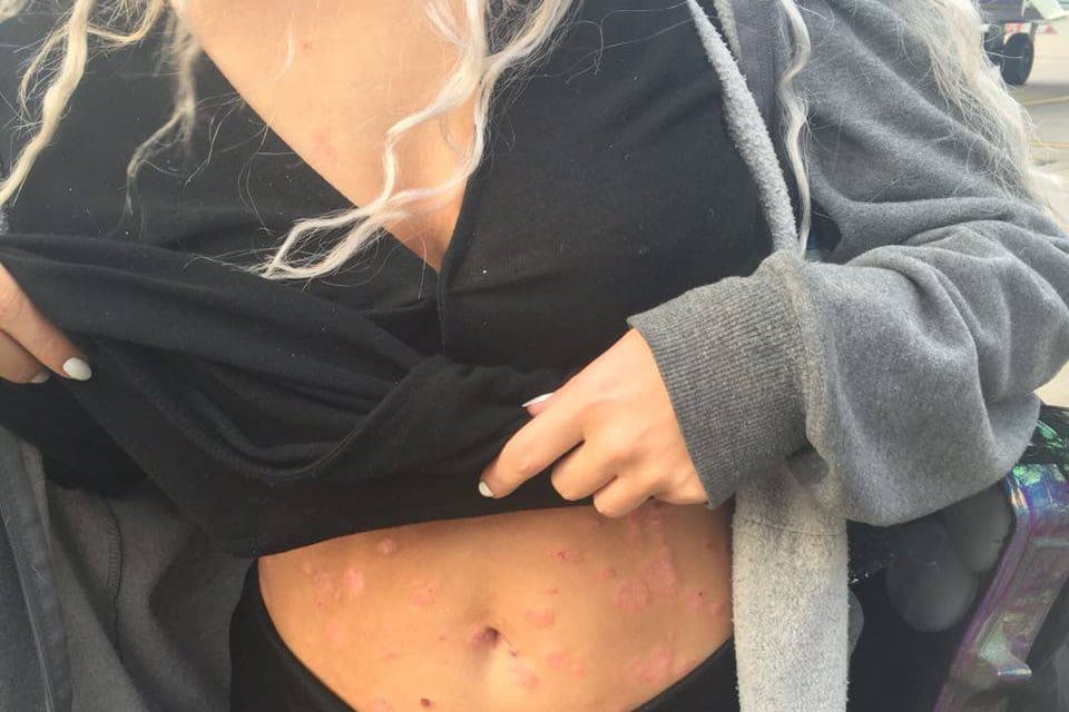 A pikkelysömör leggyakoribb oka