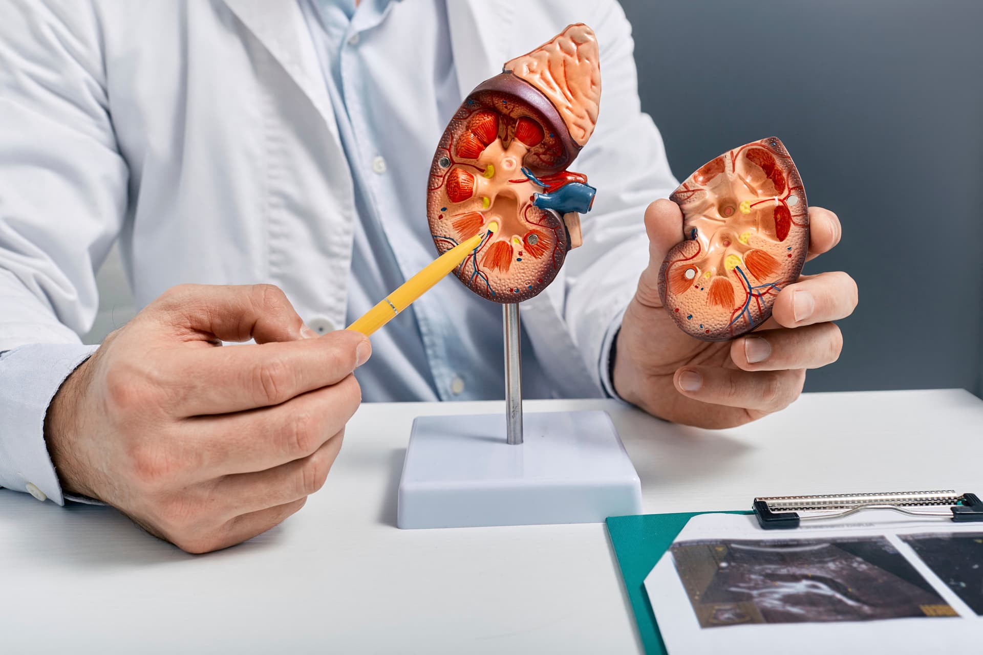 Ennek a vitaminnak a fogyasztása csökkenti a vesekő kialakulásának kockázatát